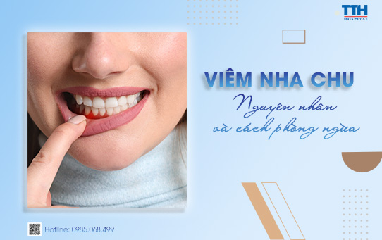 Viêm nha chu - Dấu hiệu và cách phòng ngừa